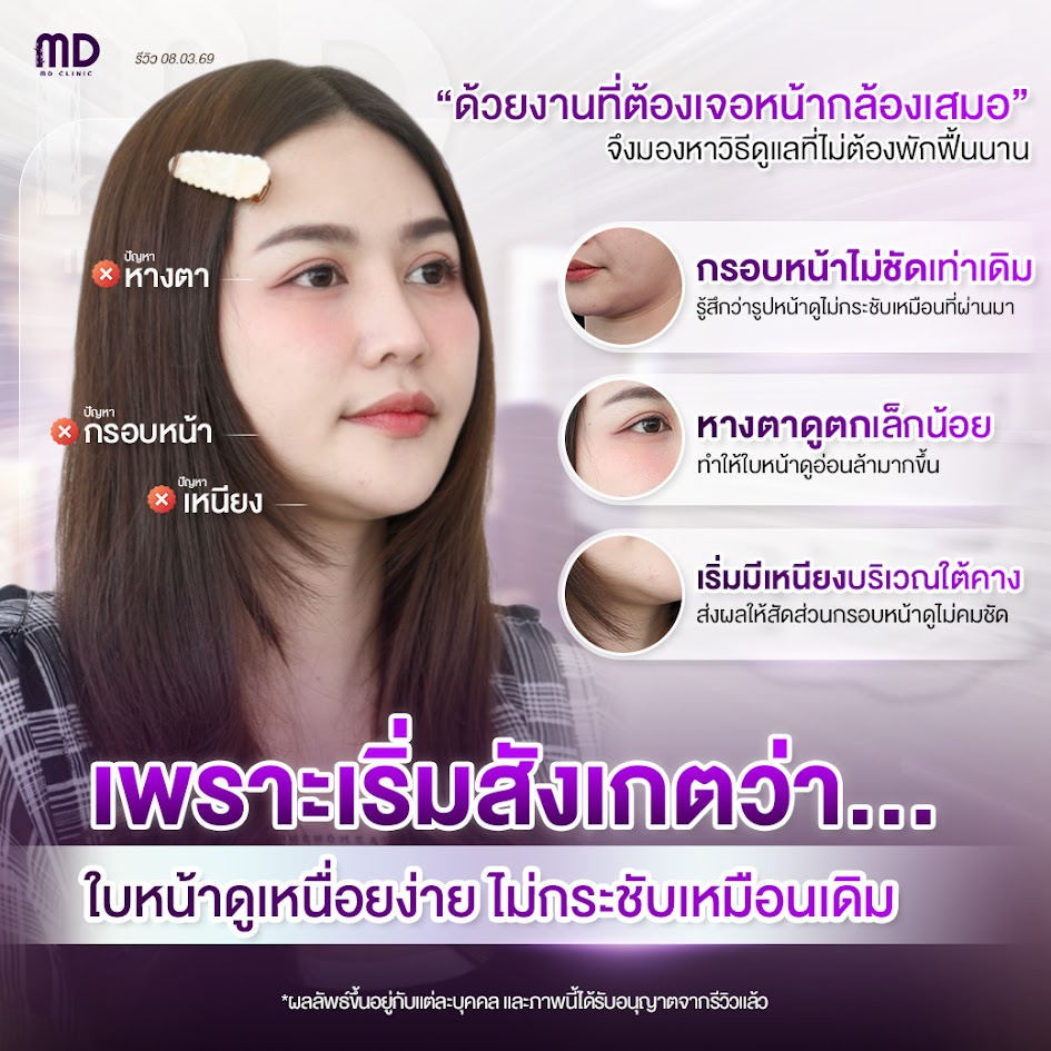 roi-mai-thread-lift-review-Bangkok-md-md-clinic(SetMhorPlaWan2)