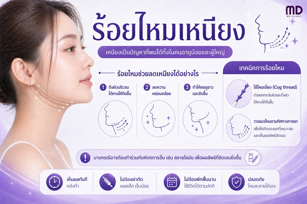 Chin thread lift