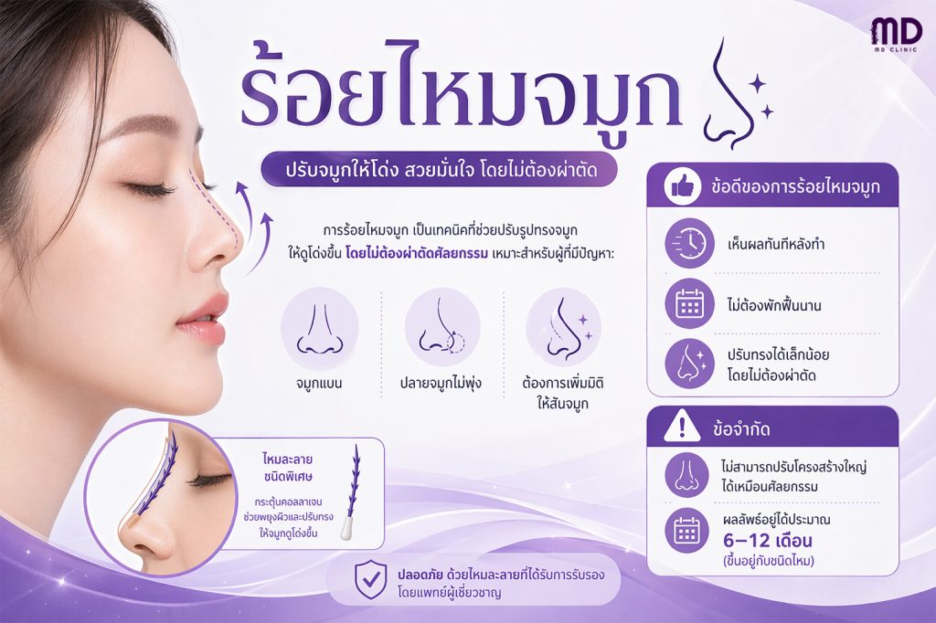 Nose thread lift