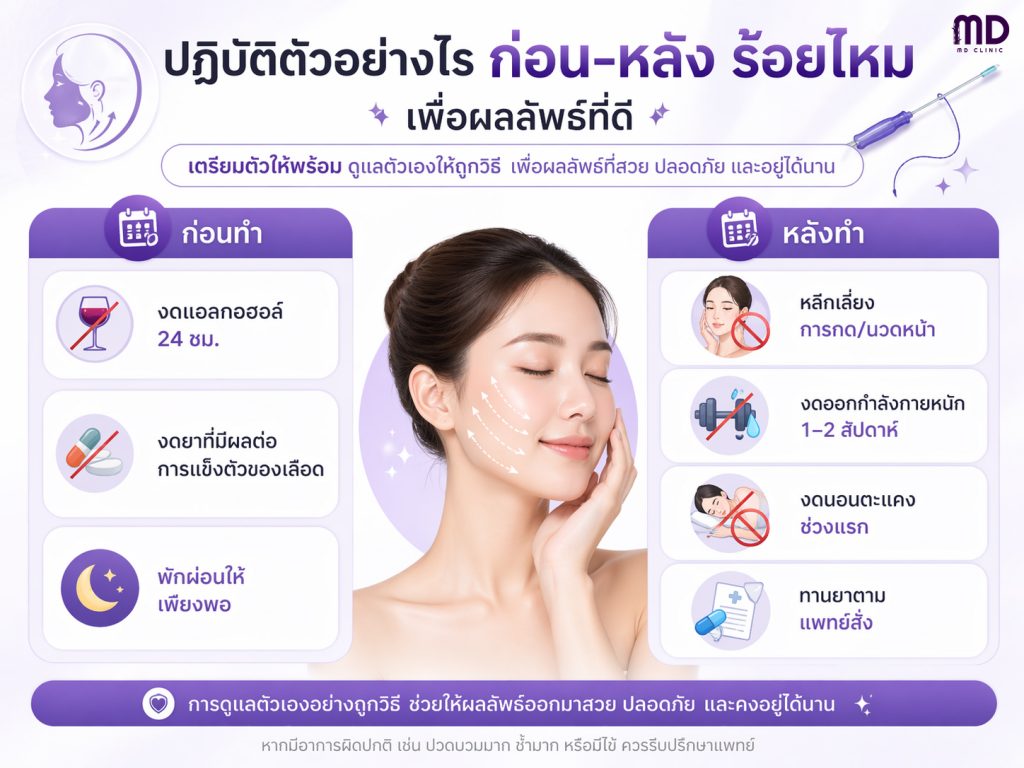 Thread lifting