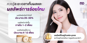 ควรรู้ระยะเวลาเห็นผลและการอยู่ได้นาน