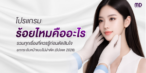 What are the benefits of thread lifting