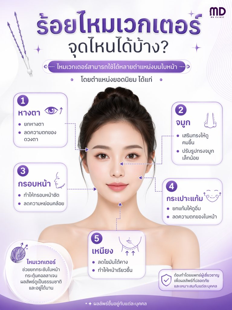 Where can I use vector thread lifting