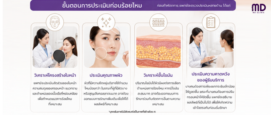 ขั้นตอนการประเมินก่อนร้อยไหมทอรืนาโด-mdmdclinic