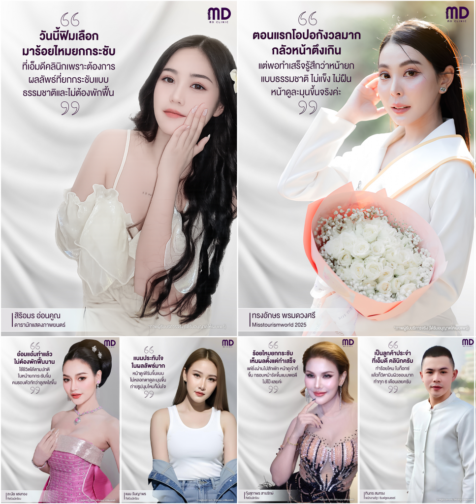 คนดังร้อยไหม-mdmdclinic