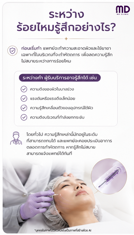 ร้อยไหมเจ็บไหม-ไหมทอร์นาโด-mdmdclinic